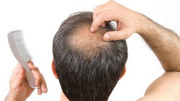 how to regrow hair diet